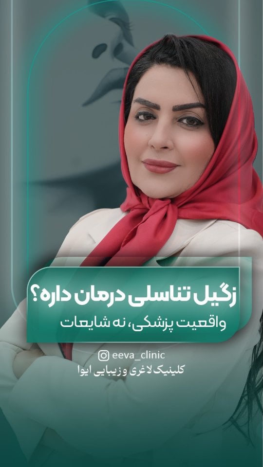 خبر خوب اینه که زگیل تناسلی درمان داره ✅اما نه با هر روشی که توی اینترنت می‌بینی…درمان درست یعنی:تشخیص دقیق + انتخاب روش مناسب + پیگیری 💚این ویدیو رو ببین تا بدونیچه کاری درسته و چی رو نباید انجام بدی.🔖 سیو کن📲 بفرست برای کسی که به این آگاهی نیاز داره#درمان_زگیل_تناسلی#HPV#سلامت_جنسی#آگاهی_پزشکی#پیشگیریریلز_آموزشیHealthReelsHPVAwarenessSexualHealth by @eeva_clinic