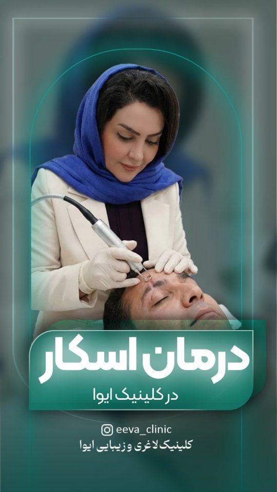 جای اسکار همیشه قرار نیست دائمی بمونه ❌اگه جای بخیه، سوختگی، جراحی یا زخم‌های قدیمی روی پوستت مونده،با روش‌های جدید درمانی می‌تونیم ظاهر اسکار رو خیلی کمتر، هموارتر و همرنگ‌تر با پوست کنیم ✅🔹 انتخاب روش درمان، کاملاً به نوع اسکار، عمق، سن زخم و پوست شما بستگی داره🔹 هر اسکاری با یک روش درمان نمی‌شه🔹 درمان اصولی = صبر + تکنیک درست + دستگاه مناسب#درمان_اسکار#جای_زخم#جای_بخیه#درمان_جای_زخم#اسکار پوست_سالمزیبایی_پوستکلینیک_پوست by @eeva_clinic