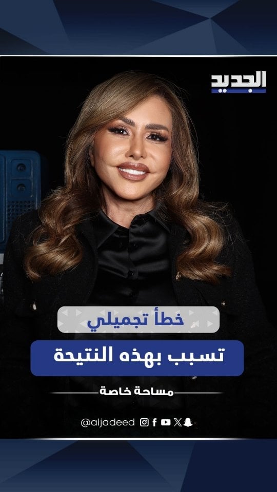 خطأ تجميلي تسبب بهذه النتيحة ... مها المصري تنهي الجدل حول وجهها وتعلق: في تنمر مو طبيعي#الجديد #مساحة_خاصة by @mahaalmasriofficial