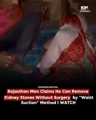 A man from Rajasthan has gone viral after claiming he can remove kidney stones without surgery using a technique he calls “waist suction.” Yes, you read that right. While most people head to hospitals and specialists, this man says a few minutes of his unusual method can solve the problem.

The video has thrown the internet into full chaos mode. Some viewers are calling it a miracle, others are demanding scientific proof, and a few are probably updating their life plans after watching one reel. The funniest part? Social media doctors, engineers, gym trainers, and self-proclaimed health experts have all suddenly united in the comment section.

As the clip spreads across platforms, debates are getting louder than ever. Is this a breakthrough, a bizarre claim, or just another viral internet moment that leaves everyone confused?

One video, one claim, and the entire internet is now diagnosing kidney stones from the comment section.

#KidneyStone #RajasthanViral #WaistSuction #ViralNews #TrendingReel